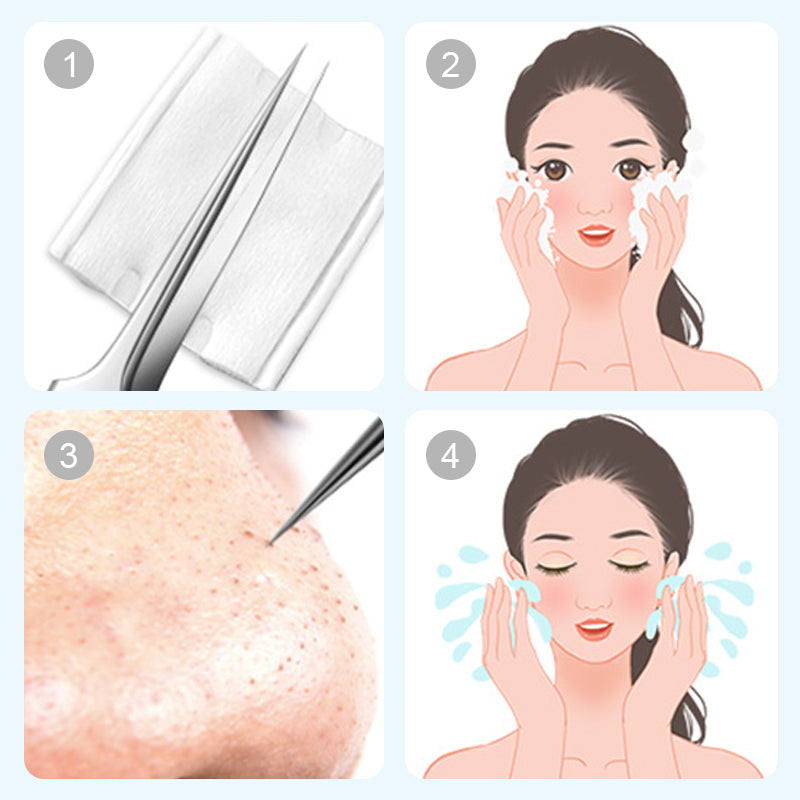 💓Stainless Steel Blackhead Remover Tool Kit💥