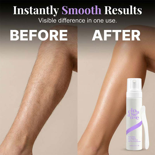 💞LAST DAY BUY 1 GET 1 FREE💞Bikini Hair Removal Cream for Sensitive Skin | Suitable for Men & Women |