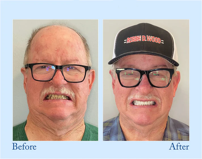 🔥Limited-time 60% Off🔥 YaGoo™ Fluoride-Free Hydroxyapatite Toothpaste – Gentle Whitening & Enamel Strength for Sensitive Teeth