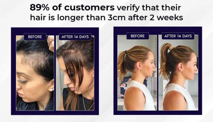 🖤Black Friday Sale 50% OFF🖤 HZA™ Natural Hair Regrowth Spray