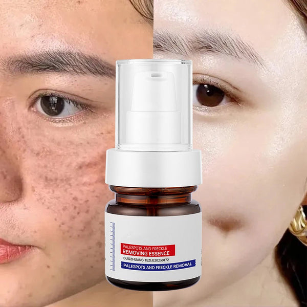 ⚡Rozjaśnianie w 5 sekund! Witamina C wybielająca piegi ESSENCE
