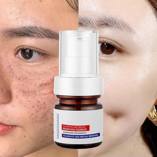 ⚡Rozjaśnianie w 5 sekund! Witamina C wybielająca piegi ESSENCE