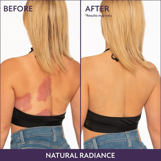 💜LAST DAY SALE BUY 1 GET 1 FREE!!💜All-in-one moisturizer, concealer & coverage Perfector