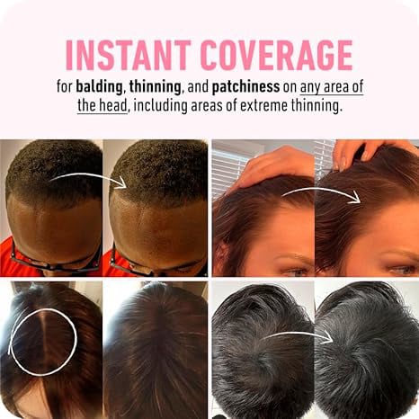 🎁Laatste dag 50% korting🎉Koop 2 en krijg 1 gratis🎁Uitgroei camoufleren voor een moeiteloos mooie look