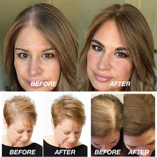 Christmas Sale- Buy 1 Take 1-stronger hair HAIR NOURISH SPRAY-Strengthen, Repair & Revitalize – Bring Your Hair Back to Life with Every Spray!