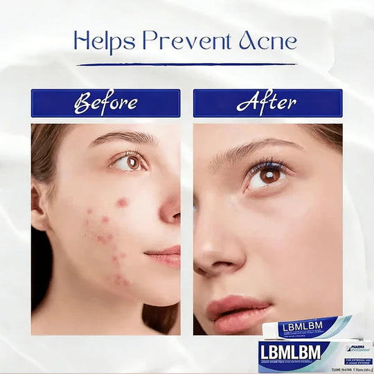 💧Vitamin A Pommade + Hyaluronic Acid Cream Duo