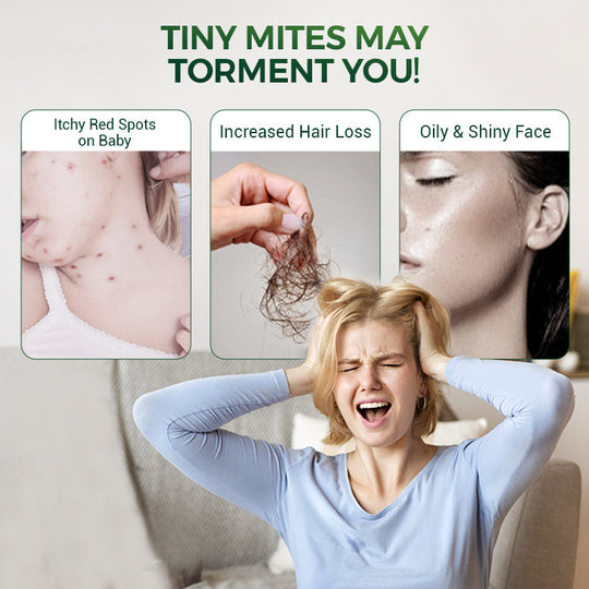 🐜 GALINGA VABZDŽIŲ ATBAIDYMO PRIEMONĖ – Momentinė uodų ir musių kontrolė, švelni odai ir be kvapo, idealiai tinka namams ir sodui 🌿🧴