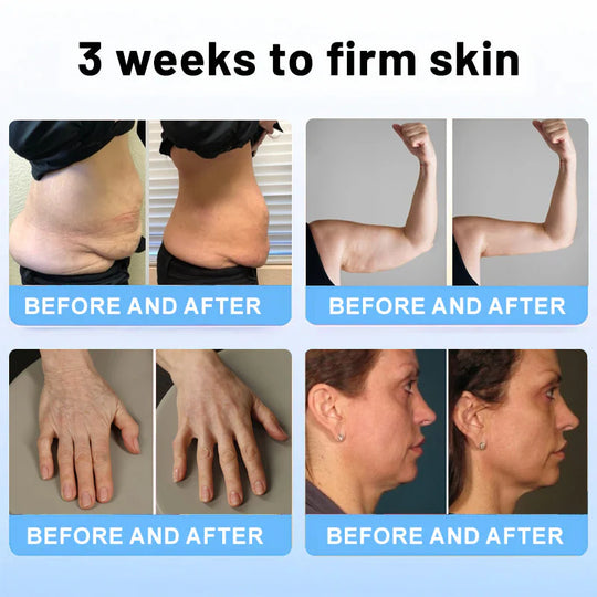 💎ODALIT™ Botox Bee Venom Firming Serum Stick(🔥LAST DAY 50% OFF)🧡