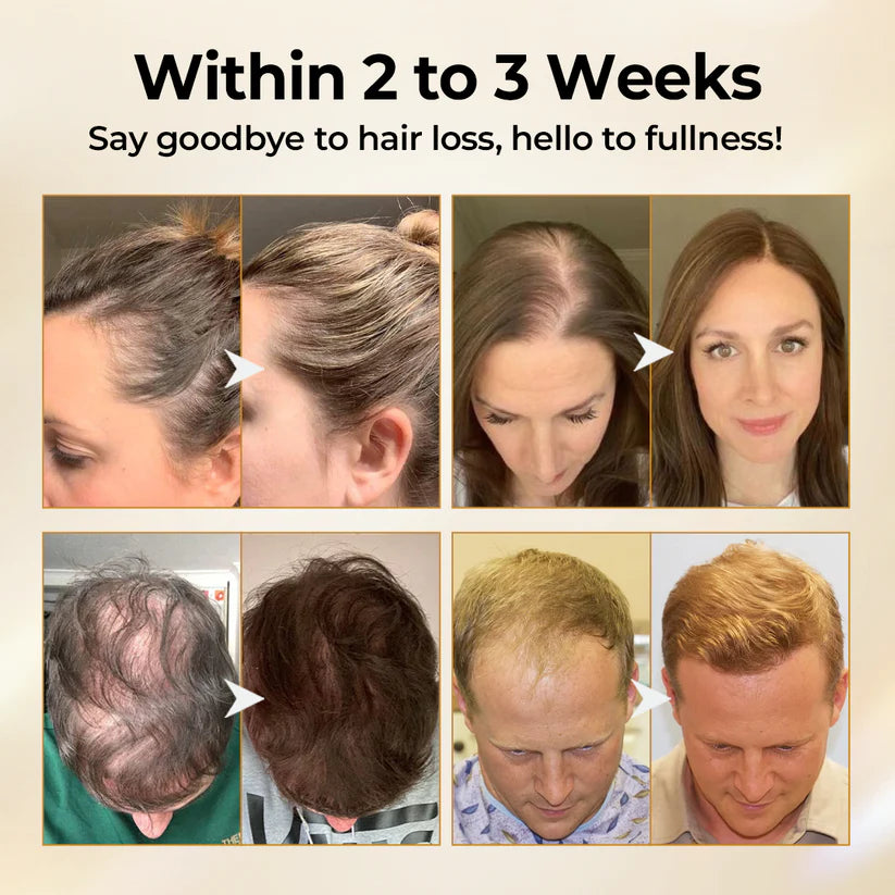 Timilk® CollagenGrow Peptides Hair Growth Spray