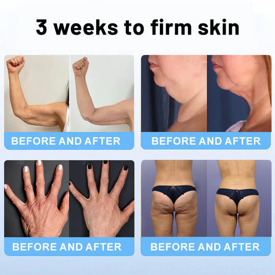 💎ODALIT™ Botox Bee Venom Firming Serum Stick(🔥LAST DAY 50% OFF)🧡