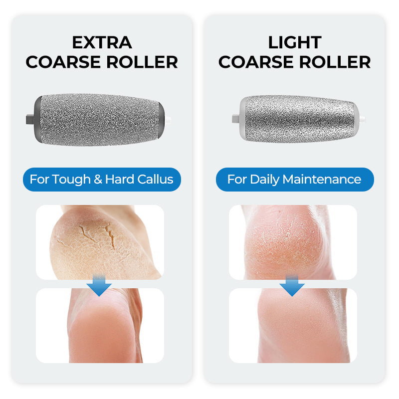 🌸Limited-Time Special!!🌸 Electric Foot Callus Remover