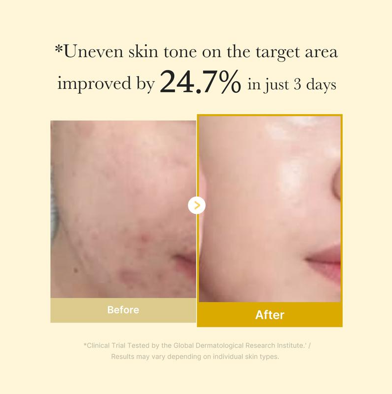 [Medicube Official] Kojic Acid Turmeric Night Wrapping Mask | Overnight Wrapping Mask, Morning Shed, Turmeric, Niacinamide, Vitamin