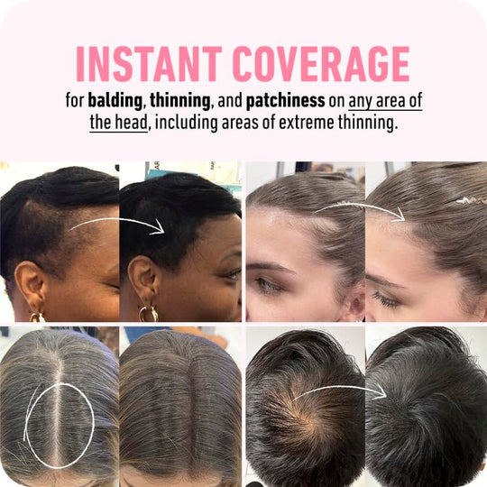 🎁Laatste dag 50% korting🎉Koop 2 en krijg 1 gratis🎁Uitgroei camoufleren voor een moeiteloos mooie look