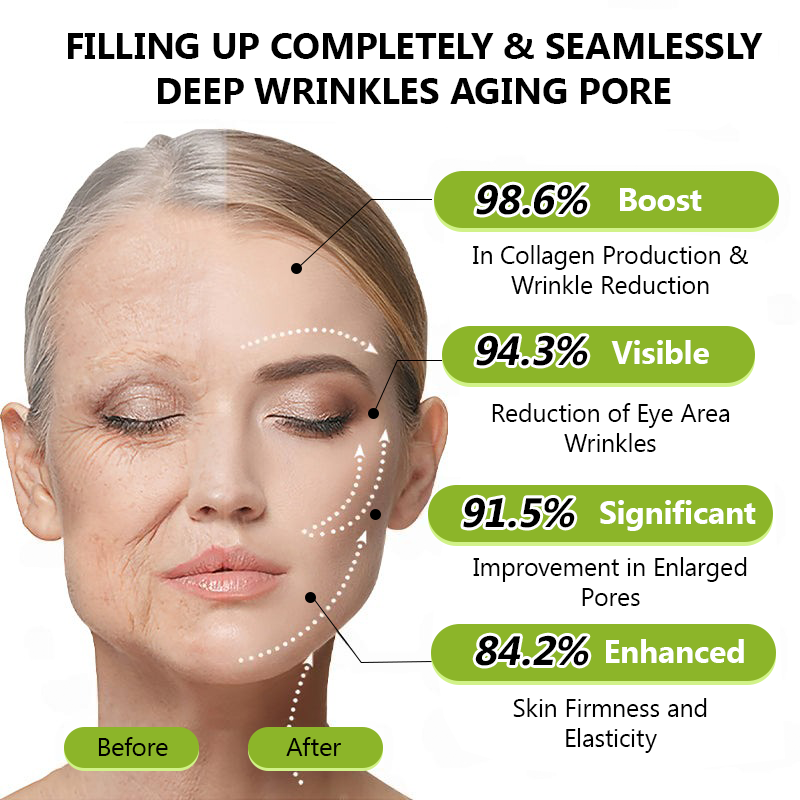 Последване👍| Възвърнете младостта на кожата си 💫STDEI® BOTOX &amp; VITA A RETINOL SHOT Крем за стягане и повдигане на бръчки