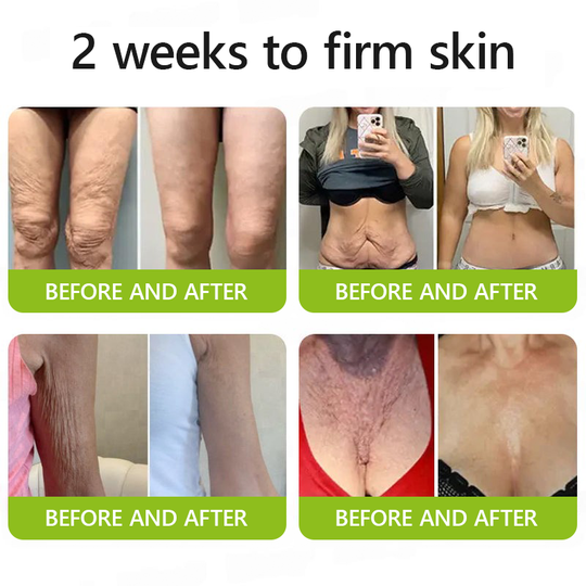 Последване👍| Възвърнете младостта на кожата си 💫STDEI® BOTOX &amp; VITA A RETINOL SHOT Крем за стягане и повдигане на бръчки