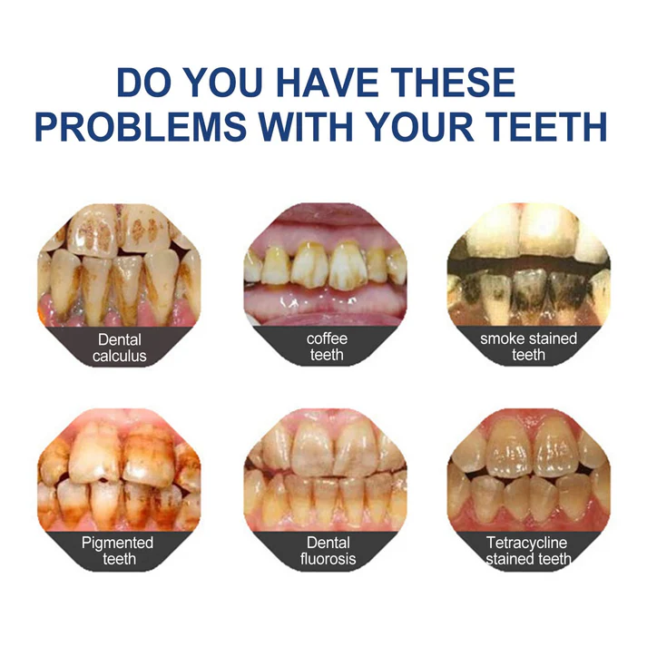 🔥Limited-time 60% Off🔥 YaGoo™ Fluoride-Free Hydroxyapatite Toothpaste – Gentle Whitening & Enamel Strength for Sensitive Teeth