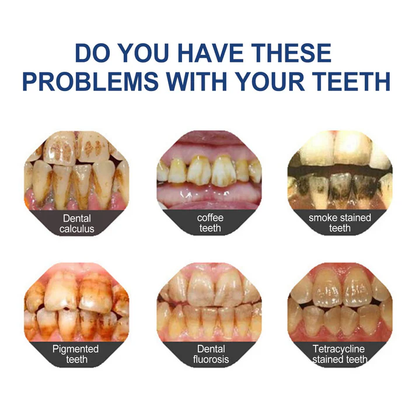 🔥Limited-time 60% Off🔥 YaGoo™ Fluoride-Free Hydroxyapatite Toothpaste – Gentle Whitening & Enamel Strength for Sensitive Teeth