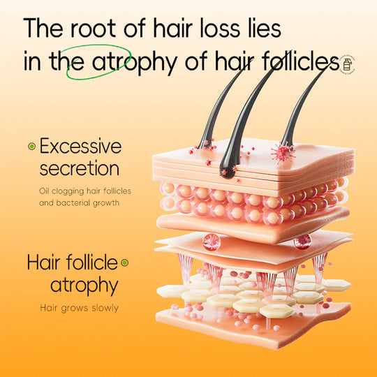 Deliiston Anti-Hair Loss Shampoo