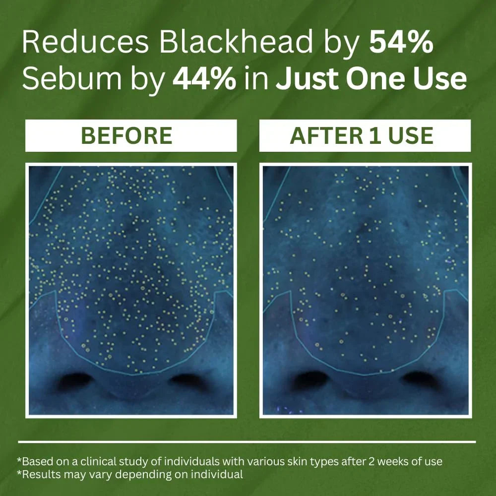 P.CALM Holy Basil Carbonated Mask: Deep Pore Cleanser, Blackhead & Sebum Control