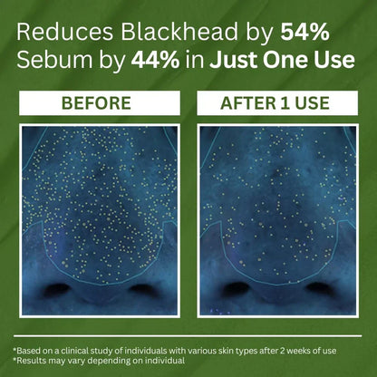 P.CALM Holy Basil Carbonated Mask: Deep Pore Cleanser, Blackhead & Sebum Control
