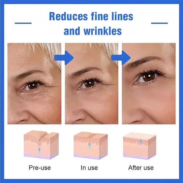 💖DERNIER JOUR DE SOLDES : 50 % DE RÉDUCTION💦essence d'acide hyaluronique