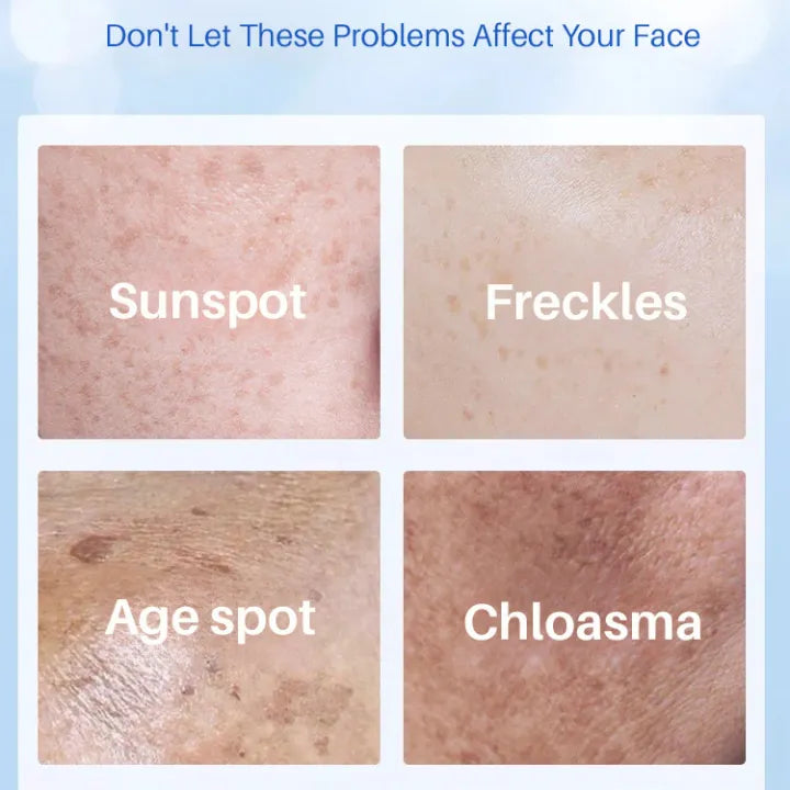 Age Spot Essence Milk Improve Skin Pigmentation Yello Essence Cream for Age Spot Reduction