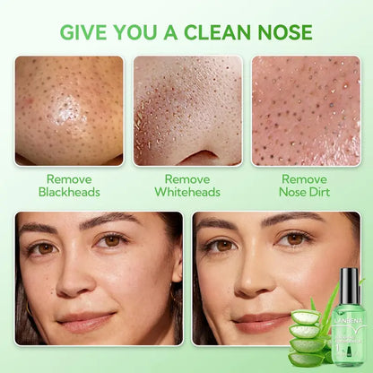 LANBENA Green Tea Blackhead Remover 100 sheet Nose Pore Strips & Pore Minimizer Serum Peel Off Mask for Pores, Nose, Chins & Face