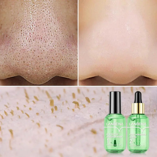 LANBENA Groene Thee Mee-eter Remover 100 vel Neuspore Strips & Pore Minimizer Serum Peel Off Masker voor poriën, neus, kin en gezicht