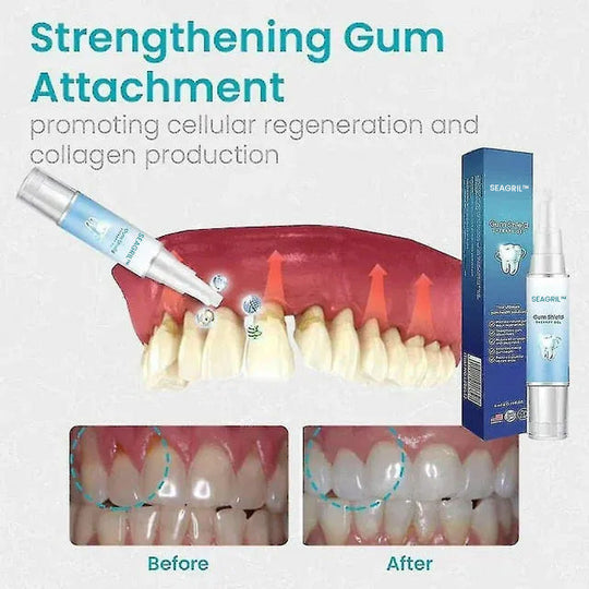 SEAGRIL™🔥Tooth Repair Gel Firm Tartar Deep Cleaning Gum Pain Repair