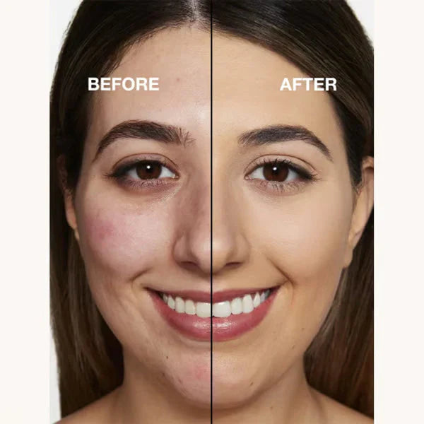 🏆Išpardavimas⚡ PARDUOTA 50 tūkst.+! Beveik nebeliko – makiažo pagrindas 4 viename – vidutinio spektro