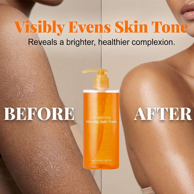 [NEW] Kojic Acid Turmeric Vita Brightening Body Wash | For Troubled Skin, Uneven Skin | K-Beauty Gentle Cleanser, Body Wash, Korean Skincare