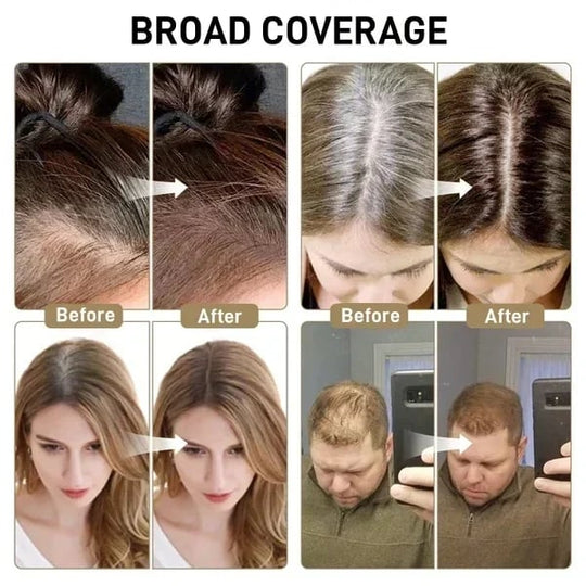 🎁Laatste dag 50% korting🎉Koop 2 en krijg 1 gratis🎁Uitgroei camoufleren voor een moeiteloos mooie look