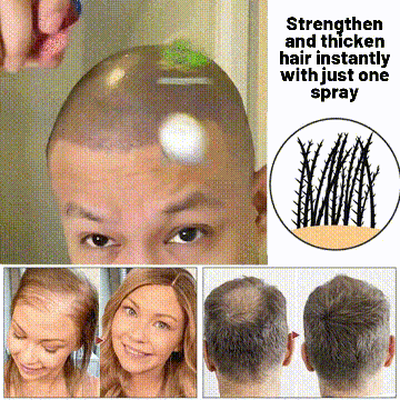 🎅Specjalna oferta świąteczna🌿HZA™ Naturalny spray do odrostu włosów