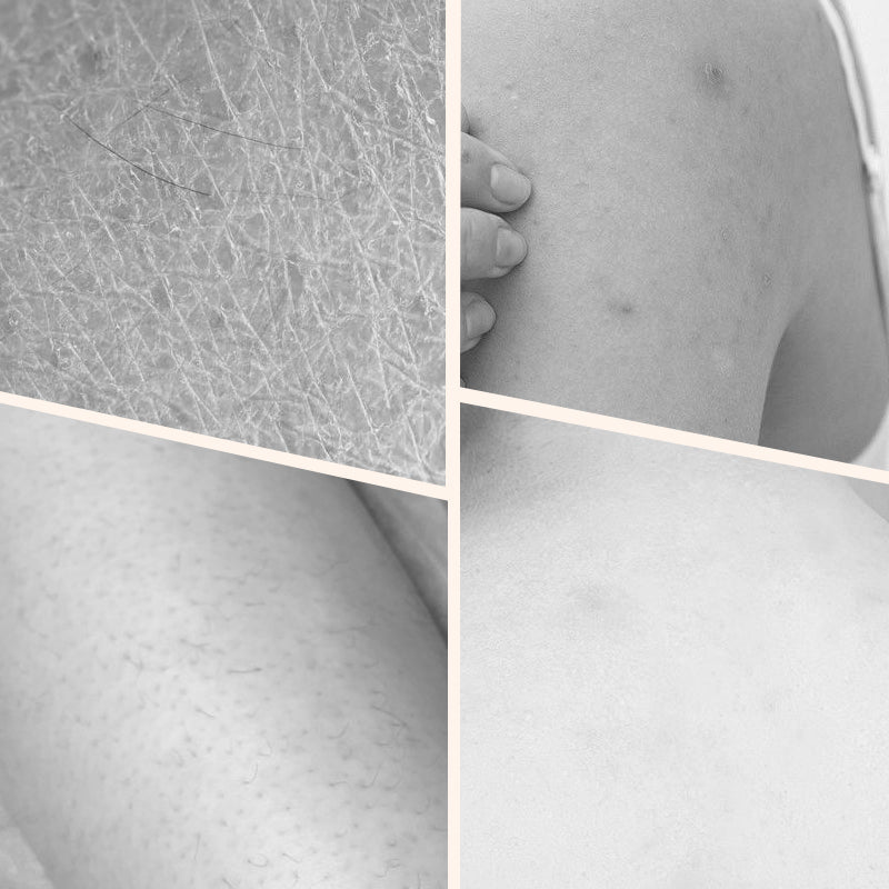 Niacinamide Double Tube balinošs ķermeņa losjons