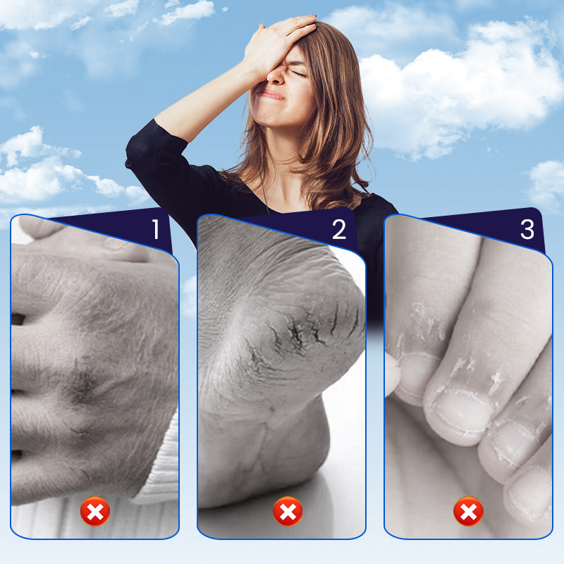 Pragunenud naha parandav plaaster kätele ja jalgadele (50% soodsamalt)