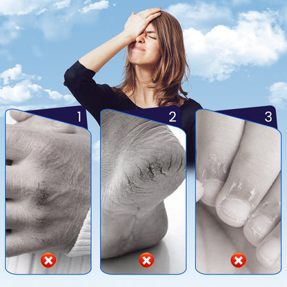 Cracked Skin Repair Patch For Hands & Feet (50% OFF)