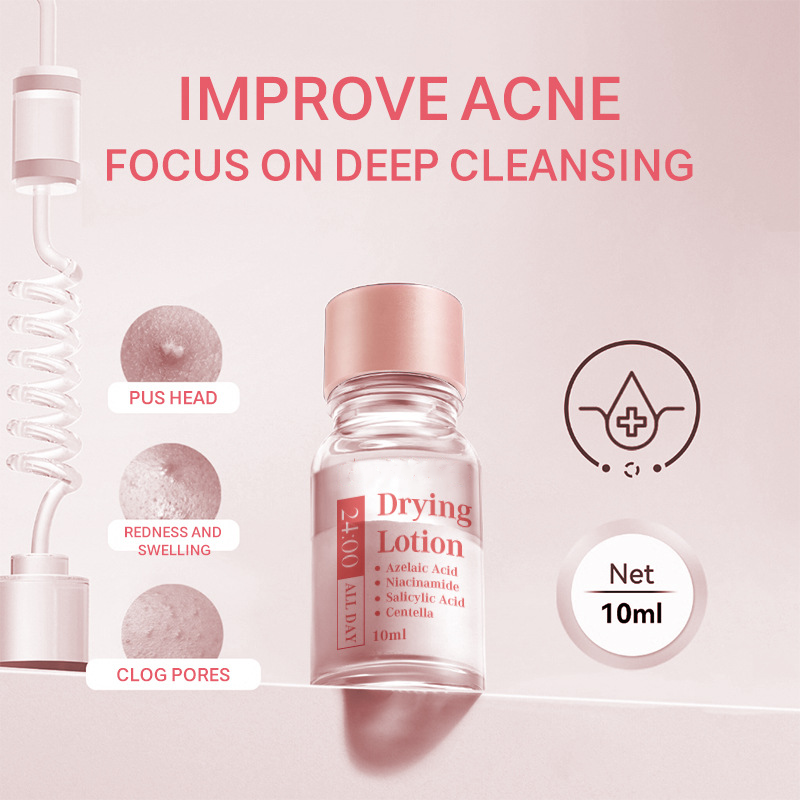 Dr.Leo 24H akne ja vistrikevastane kuivatav kreem | Põletiku leevendus, vistrikejärgne hooldus ja kõrgsurve akne leevendamine