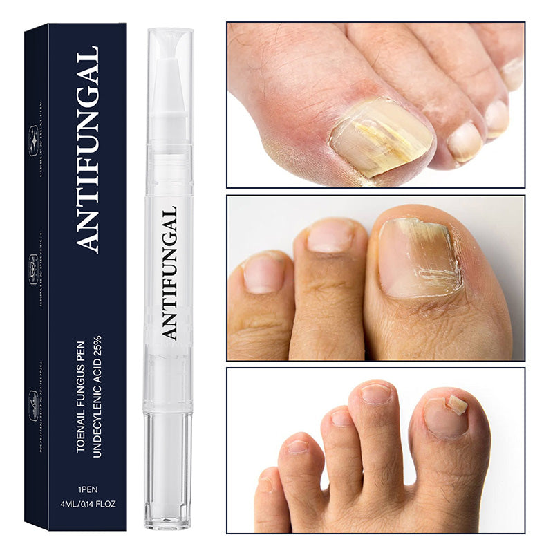 Toenail Fungus Treatment Pen for Damaged Nails