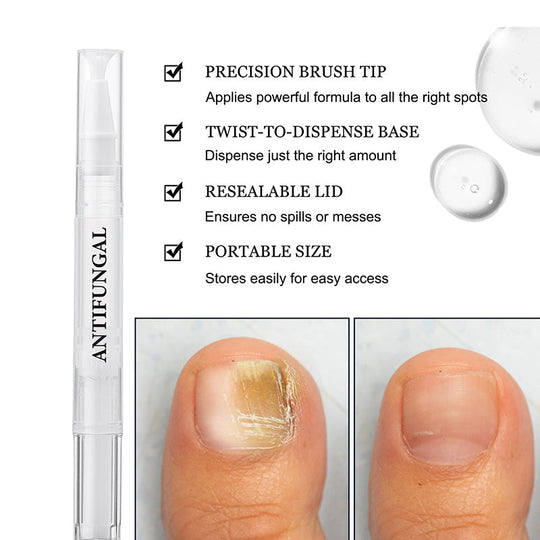 Toenail Fungus Treatment Pen for Damaged Nails