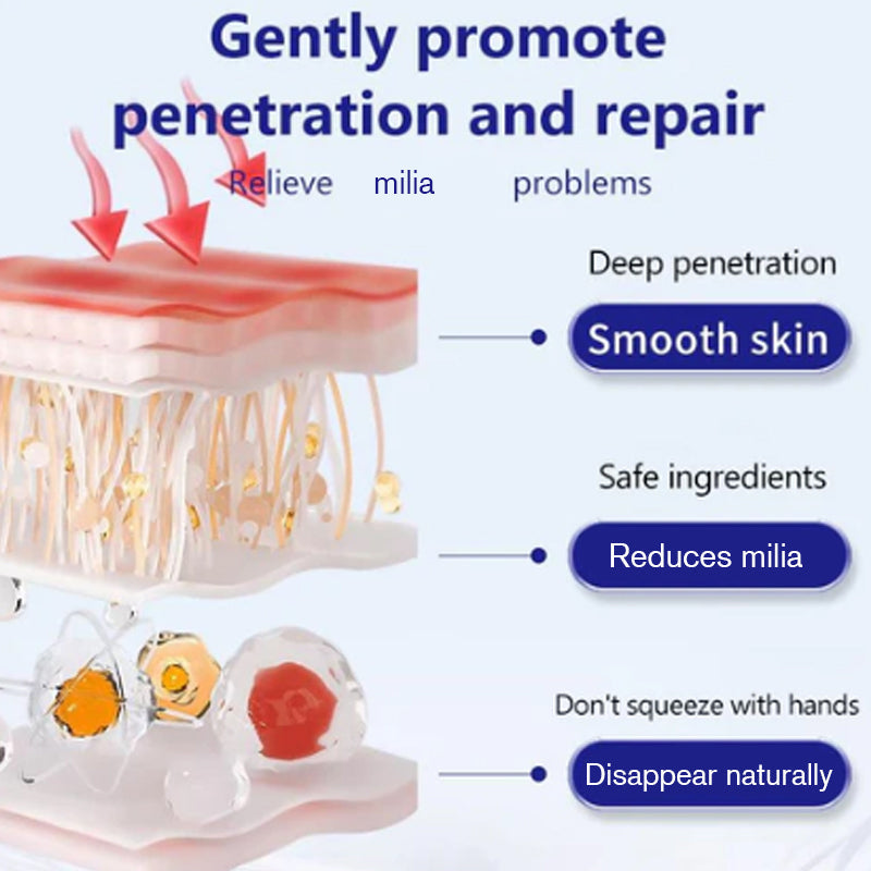 Advanced Milia Remover Serum